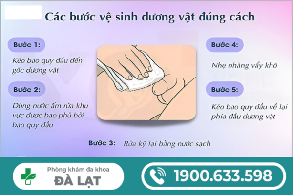 Hình ảnh minh họa